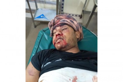 নোয়াখালীতে সড়ক দুর্ঘটনায় প্রবাসী যুবক নিহত 