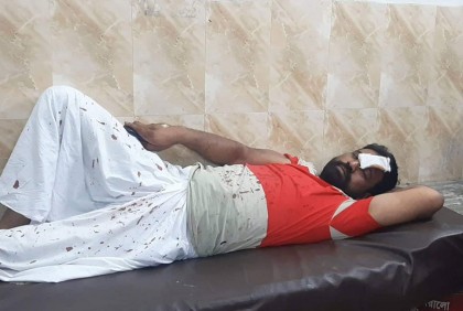 বিএনপি নেতার শিশুপুত্রের জন্মদিনের অনুষ্ঠানে হামলা, আহত ৬