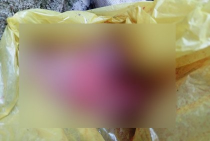ময়লার গাড়িতে পলিথিনে প্যাঁচানো নবজাতকের মরদেহ