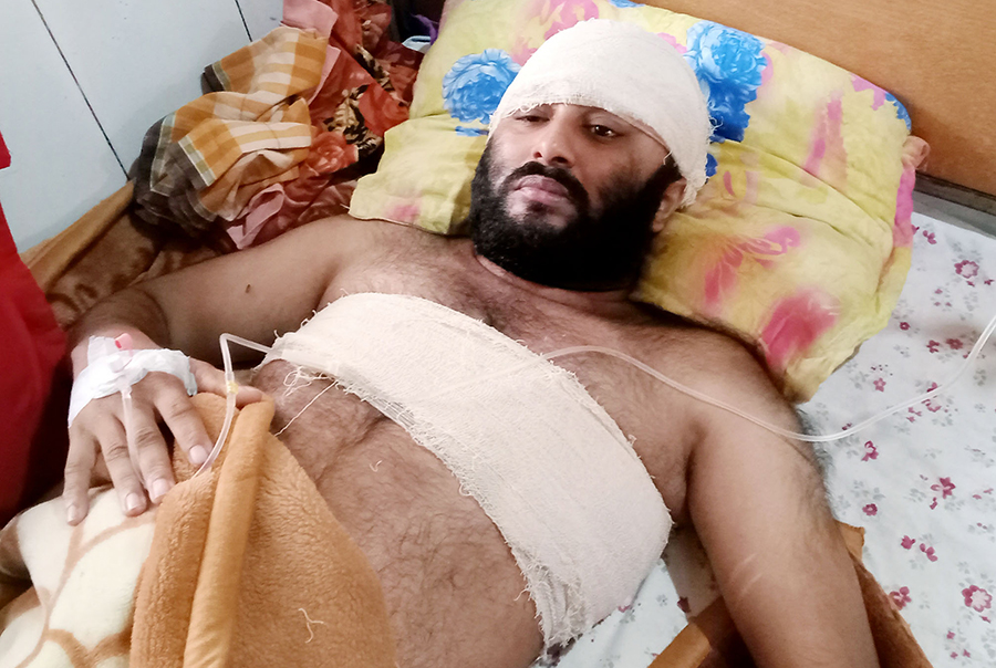 মাদকাসক্ত যুবকের অস্ত্রের আঘাতে মা ও ভাই জখম