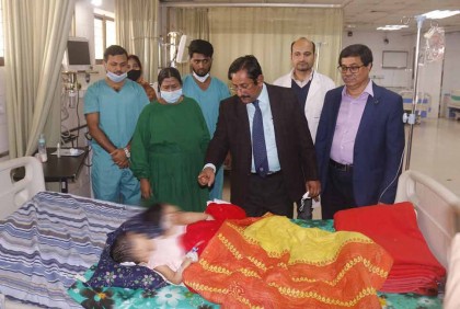 মেরুদণ্ড জোড়া লাগানো শিশু নুহা-নাবার প্রথম ধাপের অস্ত্রোপচার সম্পন্ন

