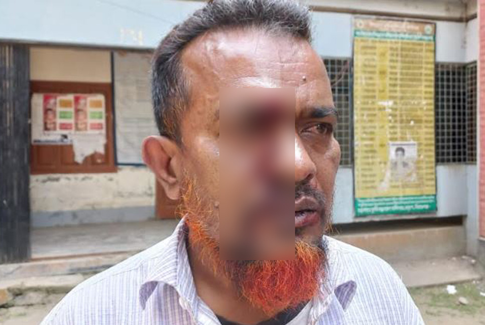 মানপত্র আনতে বিলম্ব, প্রধান শিক্ষককে পেটালেন বিদায়ী শিক্ষক