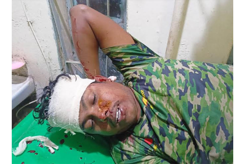 পাওনা টাকা চাওয়ার সময় কাঁচির আঘাতে যুবক আহত