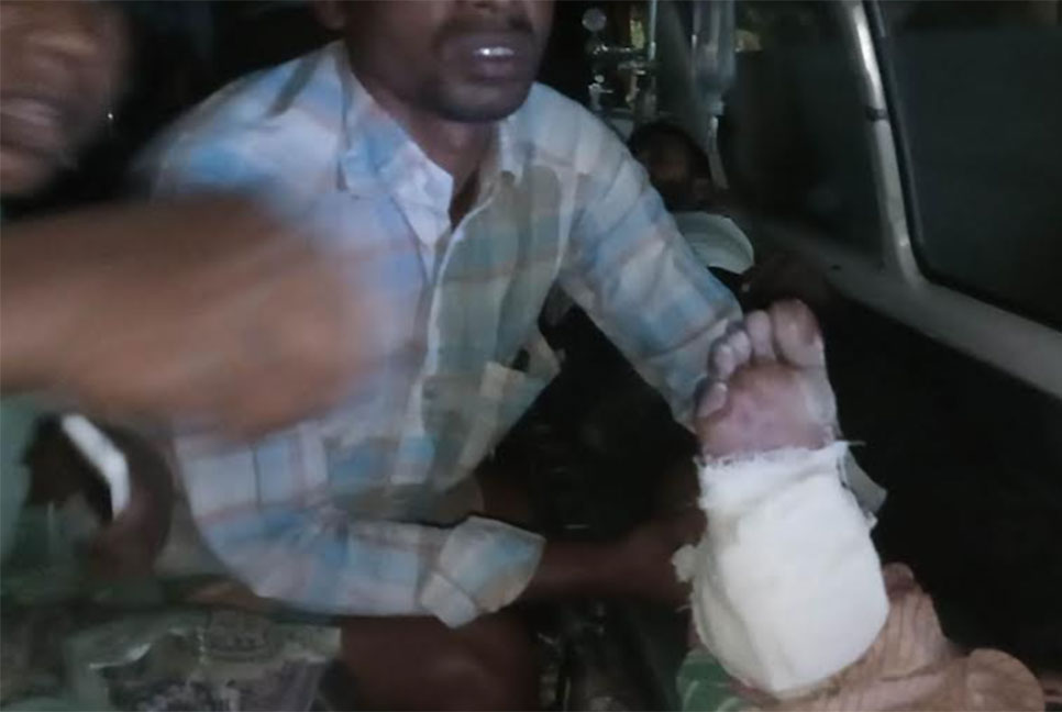 কুড়িগ্রামে পরিত্যক্ত মর্টার শেল বিস্ফোরণে 
আহত ১