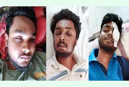 দৃষ্টি হারাতে বসছেন রাবির তিন শিক্ষার্থী