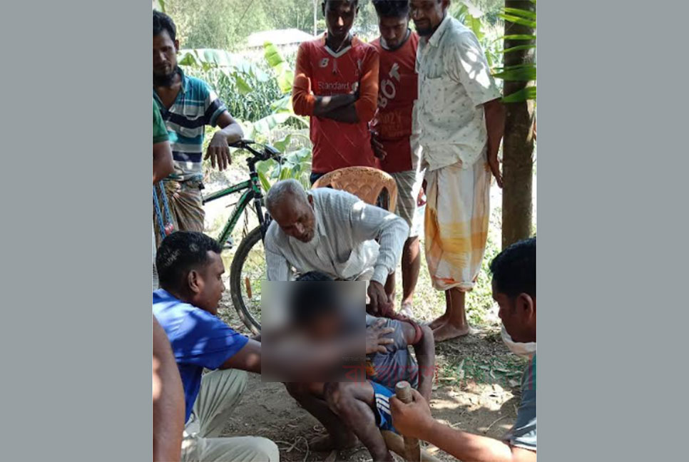 কিশোরকে মধ্যযুগীয় কায়দায় নির্যাতন, থানায় অভিযোগ