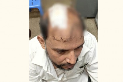 ছাদের পলেস্তারা খসে পড়ে দুদক কর্মকর্তা আহত