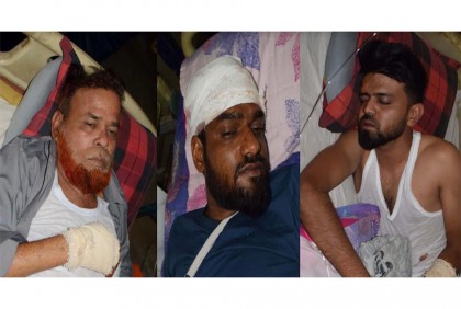 রংপুরে জামিনে এসে মামলার
বাদীপক্ষকে মারধর, আহত ৩