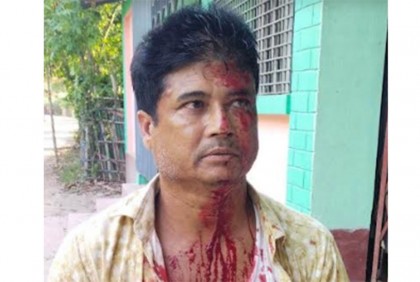 হরিণ শিকার মামলার আসামির হামলায় 
সুন্দরবন কর্মকর্তা আহত