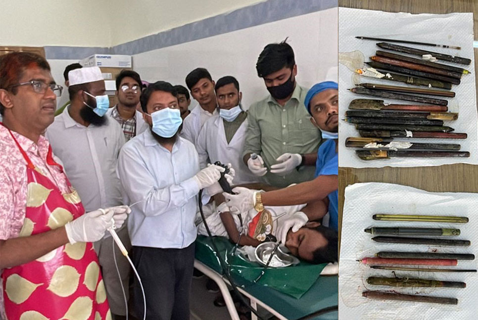 অপারেশন ছাড়া আরও ৮টি কলম বের করা হল সেই যুবকের পেট থেকে