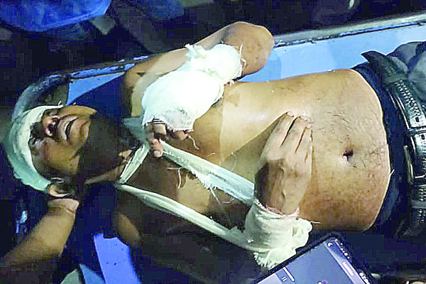 সোনার দোকান লুট, ডাকাতের গাড়িচাপায় পথচারী নিহত