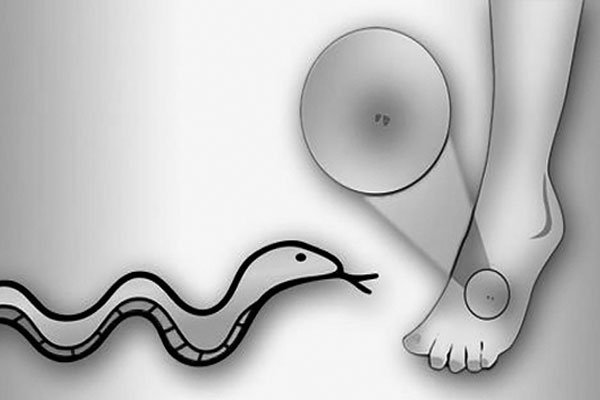 সাপের কামড়ে প্রাণ গেল কিশোরের