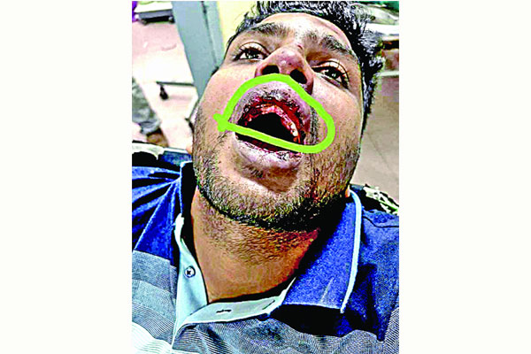 এডিসি হারুনে তোলপাড়