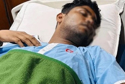 ‘এডিসি হারুনের মারধরে ছাত্রলীগ নেতার ৪-৫টি দাঁত তুলে ফেলা হয়েছে’

