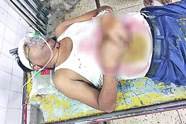 শীর্ষ সন্ত্রাসীকে এলোপাতাড়ি গুলি, পথচারীসহ আহত ২