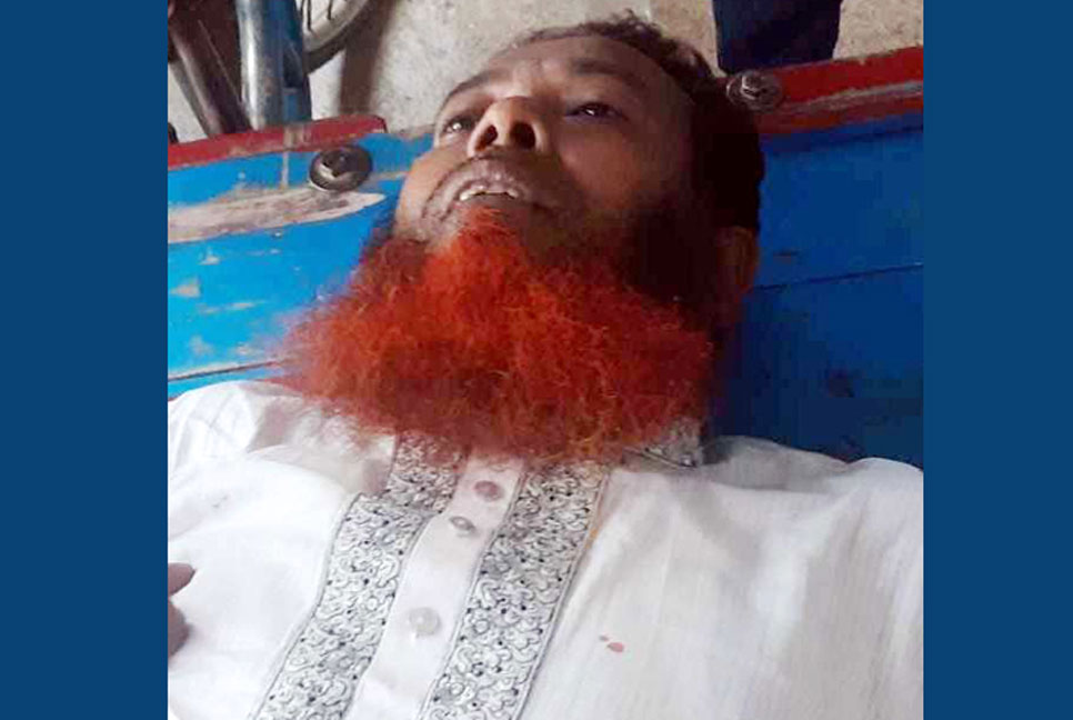 স্কুলশিক্ষকের দুই পায়ের রগ কেটে দিল দুর্বৃত্তরা