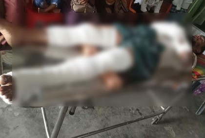 রাস্তা নিয়ে দ্বন্দ্বে গাড়ি চালককে কুপিয়ে জখম বিএনপি নেতার