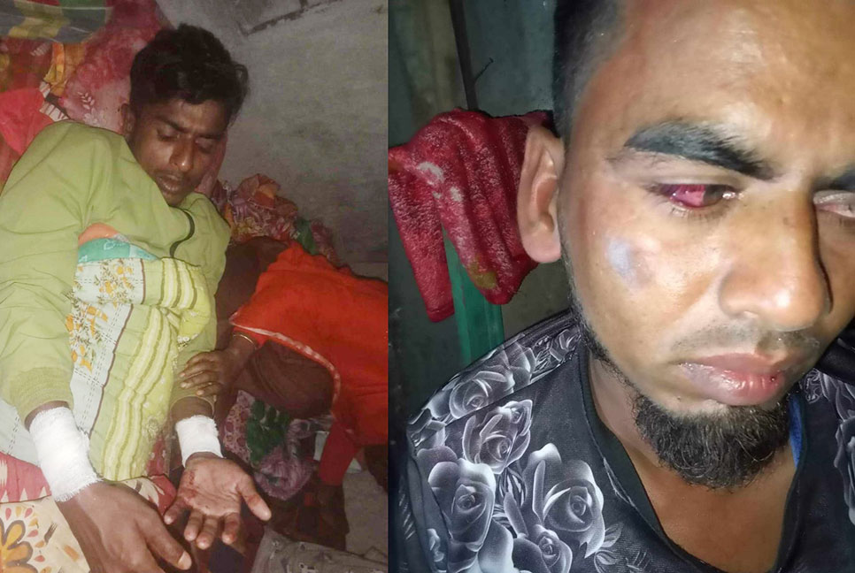 বরিশালে আওয়ামী লীগ কর্মীর চোখ তোলার চেষ্টা, রগ কাটার অভিযোগ