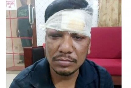 গরু চুরি করে পালিয়ে যাওয়ার সময়
আটক করে পুলিশে সোপর্দ