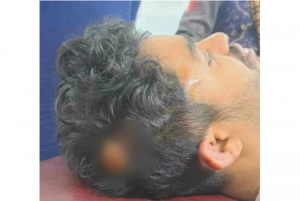 সাংবাদিককে রড দিয়ে পেটানোর অভিযোগ ছাত্রলীগের নেতাকর্মীদের বিরুদ্ধে