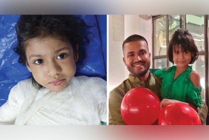 ফায়ার গেমসে আসক্ত শিশু নিজের গায়ে আগুন দিল