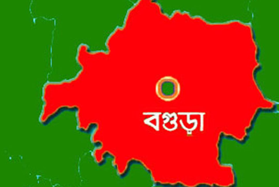 বগুড়ায় সেই নারীর গলার ভেতর গুলির অস্তিত্ব পেয়েছে চিকিৎসকরা

