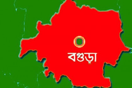 বগুড়ায় সেই নারীর গলার ভেতর গুলির অস্তিত্ব পেয়েছে চিকিৎসকরা

