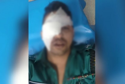 তৃতীয় লিঙ্গের লোকজনের হামলায় চোখ হারানোর শঙ্কায় এসআই
