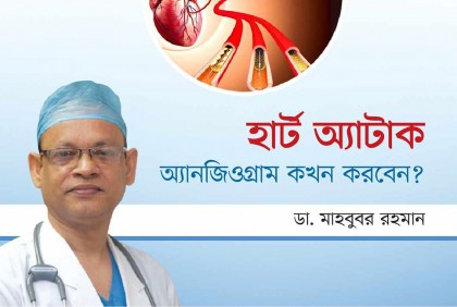 অ্যানজিওগ্রাম কখন করবেন?