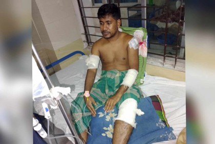 সংঘর্ষের মধ্যে প্রতিপক্ষ ভেবে ইবি ছাত্রকে কুপিয়ে জখম