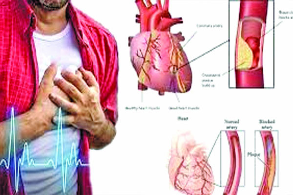 বিভিন্ন পর্যায়ে হার্ট ব্লক