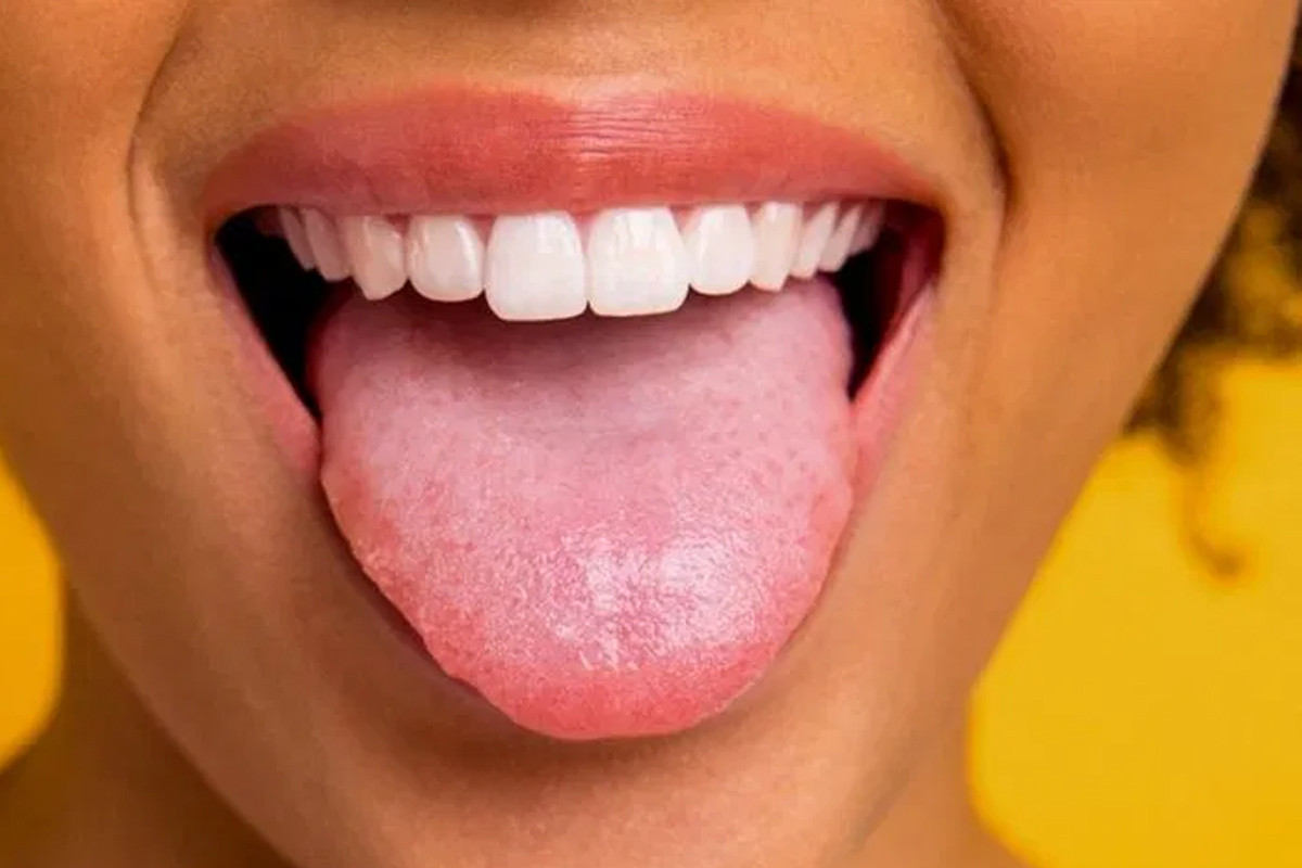 জিহ্বা দেখে স্বাস্থ্যের অবস্থা বোঝার উপায়