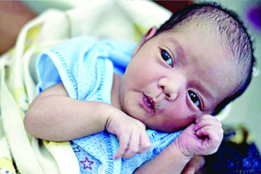 বছরে ৩ লাখ শিশুমৃত্যুর কারণ জন্মগত ত্রুটি