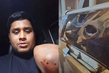 হাসনাতের গাড়িতে হামলা : গাজীপুরে ১০০ জনের নামে মামলা