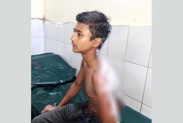 কিশোর কর্মচারীর গায়ে ভাতের গরম মাড় ঢেলে দিল বাবুর্চি
