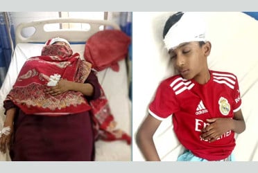 চাঁদপুরে ড্রেনের গ্যাস বিস্ফোরণে মা-ছেলেসহ আহত ৩
