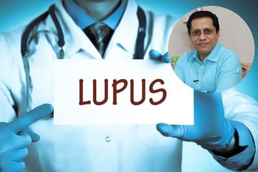 শিশুদেরও লুপাস হতে পারে
