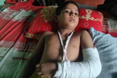 শিক্ষকের বিরুদ্ধে মাদ্রাসা ছাত্রের হাত ভেঙে দেওয়ার অভিযোগ