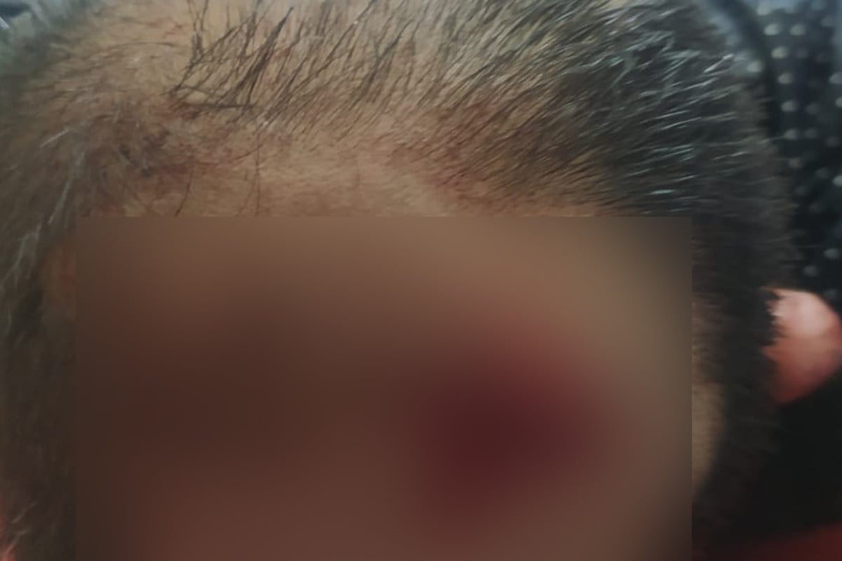 অতিরিক্ত ভাড়া নেওয়ার প্রতিবাদ করায় মাথা ফাটলো যাত্রীর!