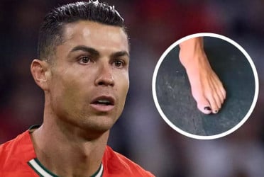 কেন রোনালদো নখে কালো নেইলপলিশ ব্যবহার করেন?