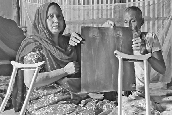 চিকিৎসার অভাবে মানবেতর জীবন ছপুরজানের