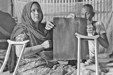 চিকিৎসার অভাবে মানবেতর জীবন ছপুরজানের