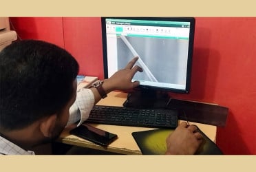 সাপের হাড়ে ফাটল, এক্স-রে করে পাঠানো হচ্ছে ঢাকায়