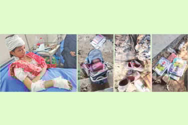 যন্ত্রণায় কাতরাচ্ছে শিশুরা