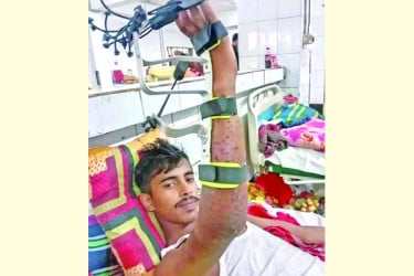 হাসানের শরীরে ৪০০ স্পিন্টার