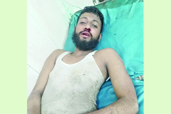 মব তৈরি করে নৃশংসতা এবার সাংবাদিকের ওপর
