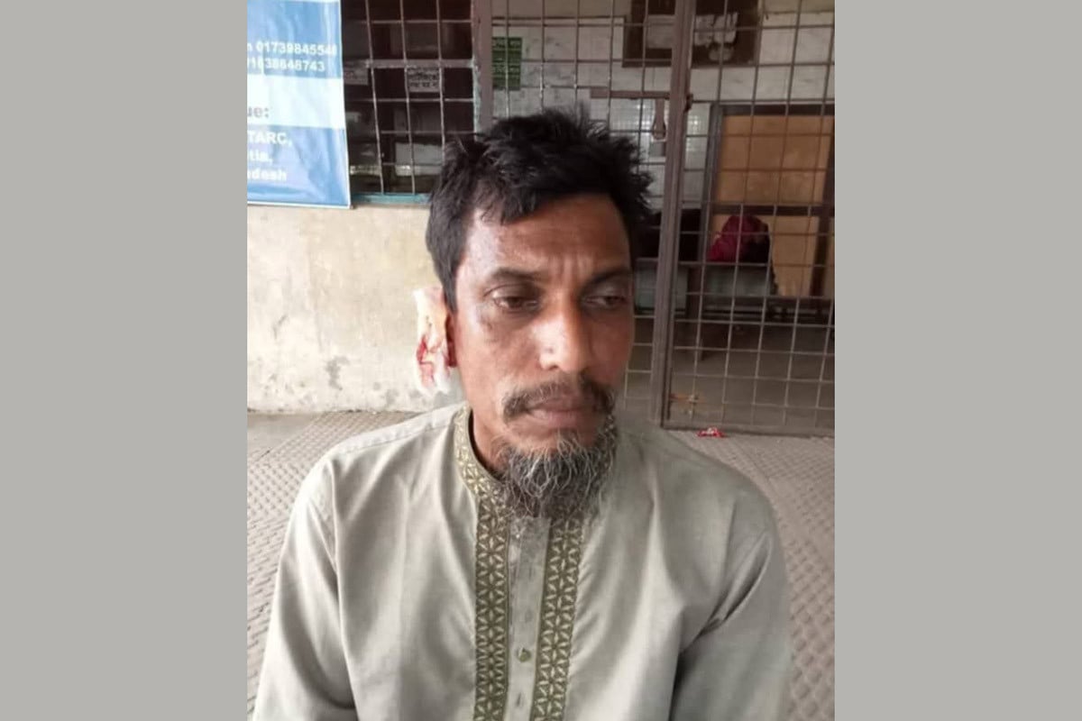 বাকিতে সিগারেট না দেওয়ায় দোকানির কান কামড়ে ছিঁড়ে দিল যুবক