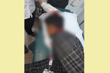 লাইভ চলাকালে আঘাতে আহত বাংলাদেশ প্রতিদিনের মাল্টিমিডিয়া রিপোর্টার দুর্জয়