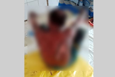 দুই সতীনের ঝগড়ায় ঘরে আগুন, শিশুসহ দগ্ধ ৩