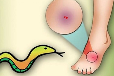গাজীপুরে সাপের ছোবলে এক নারীর মৃত্যু